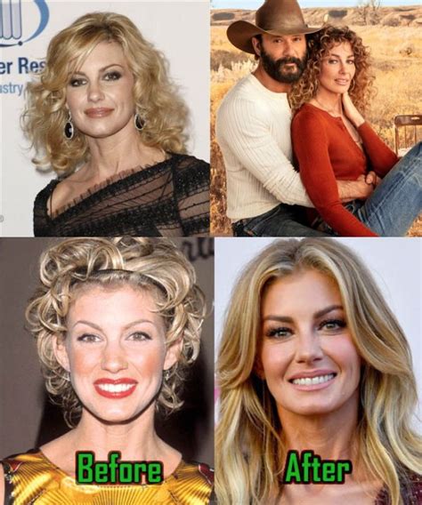 has faith hill had plastic surgery|Faith Hill embraces aging despite being。